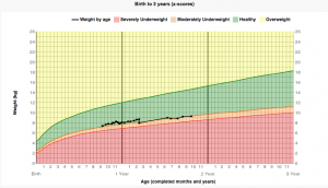 Underweight-Status-Boy-300x172